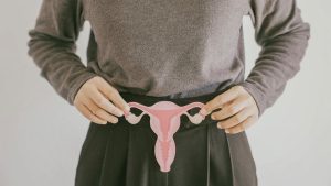 Cerita Wanita Surabaya Idap Kista Sebesar 33 Cm