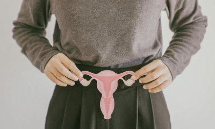 Cerita Wanita Surabaya Idap Kista Sebesar 33 Cm